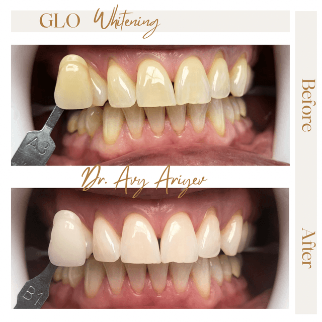 Smile Studio of Great Neck photo