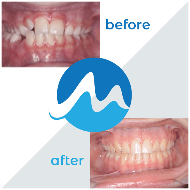 Monmouth-Ocean Orthodontics photo