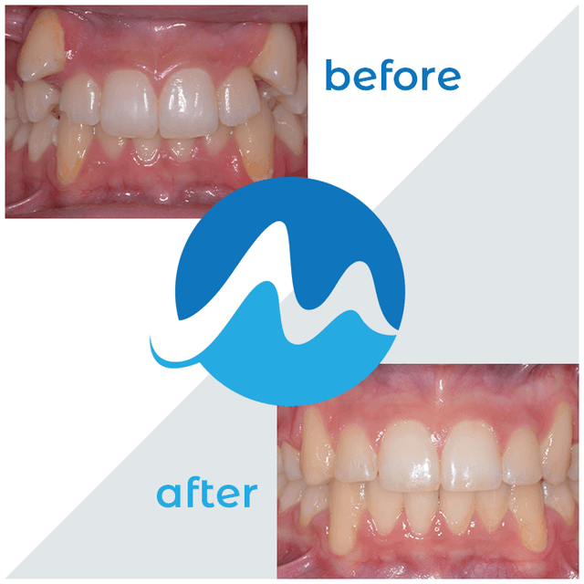 Monmouth-Ocean Orthodontics photo