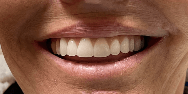 Humble Smiles photo