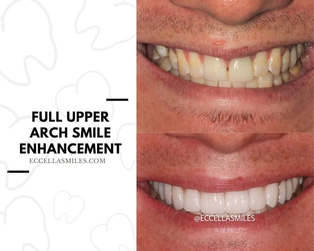Eccella Smiles & Aesthetics photo