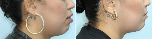 Alamo Ranch Orthodontics photo