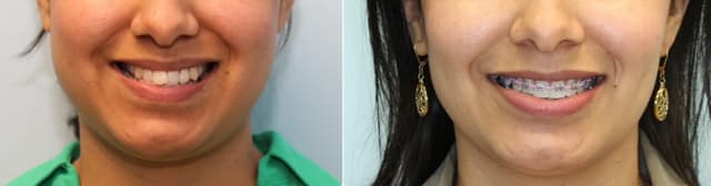Alamo Ranch Orthodontics photo