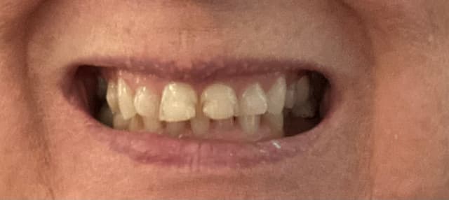 Brilliant Smiles Lakeland photo