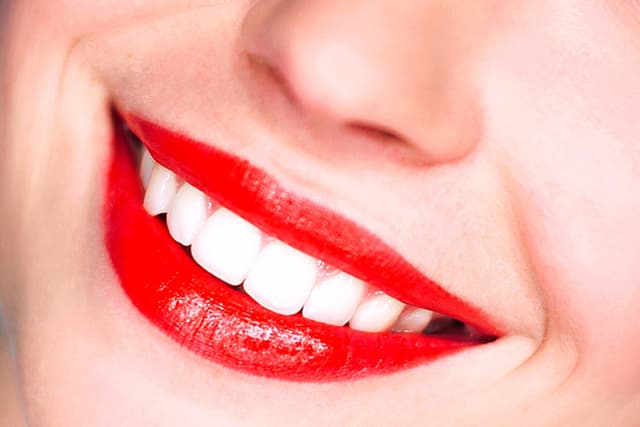 Magic Smile photo