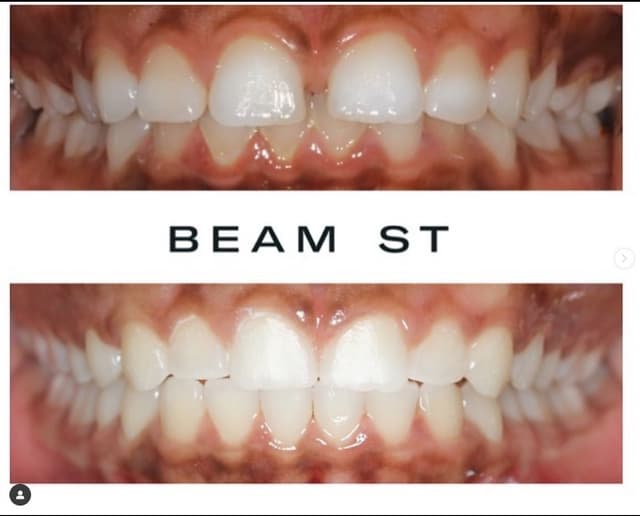 Beam Street - Union Square photo