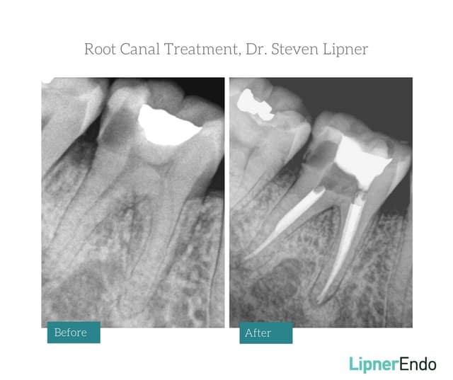 Midtown Endodontist NYC photo