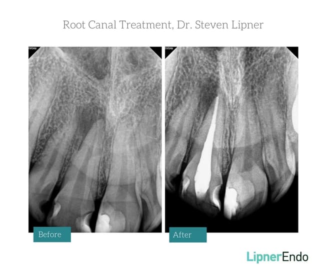 Midtown Endodontist NYC photo