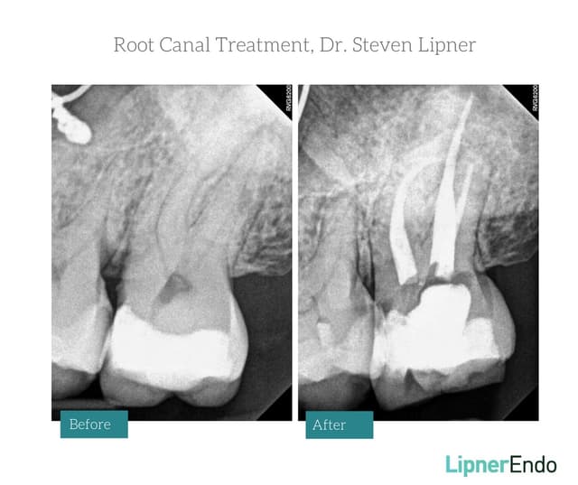 Midtown Endodontist NYC photo