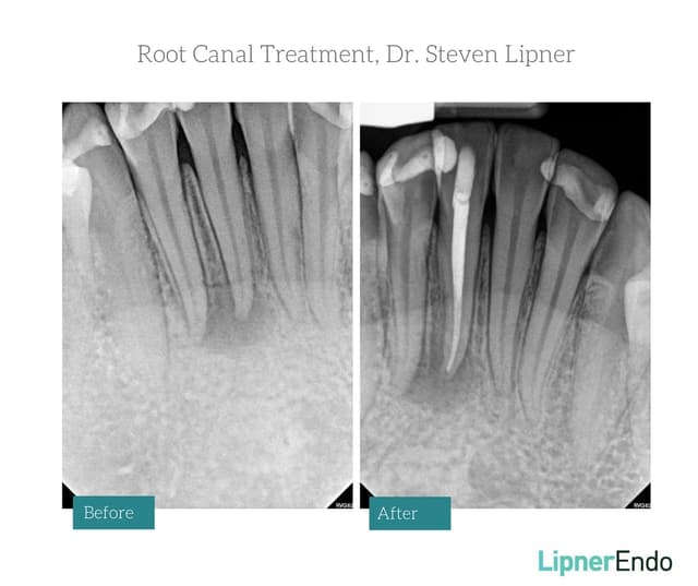Midtown Endodontist NYC photo