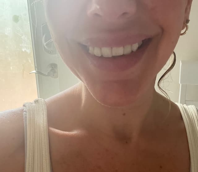 Clearsmile - Invisalign photo