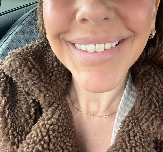 Clearsmile - Invisalign photo