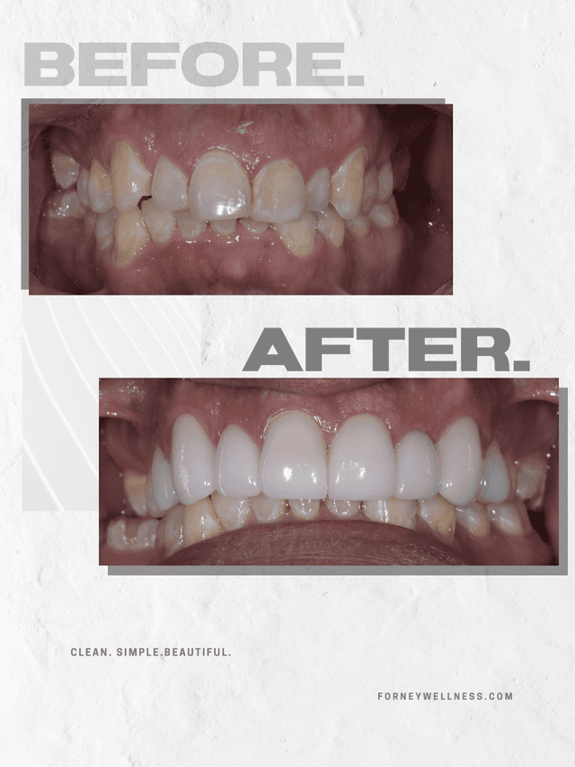 Forney Wellness photo