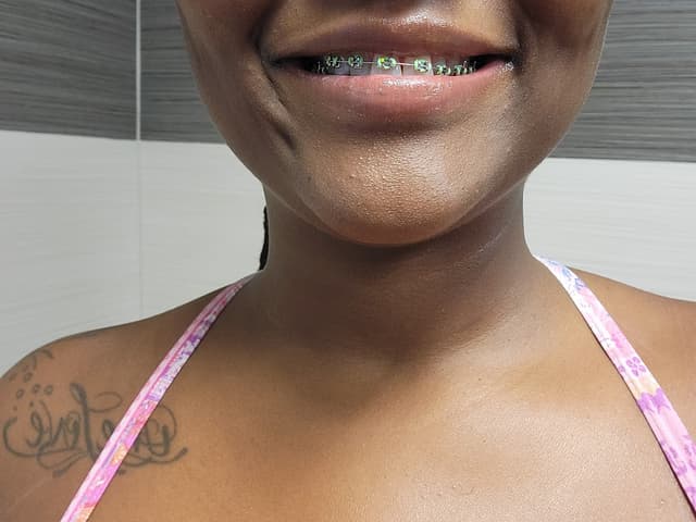 Esteem Braces & Aligners - North Miami Beach photo
