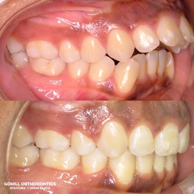 Gohill Orthodontics Aventura photo