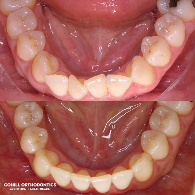 Gohill Orthodontics Aventura photo