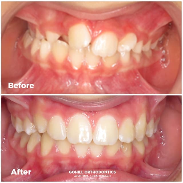 Gohill Orthodontics Aventura photo