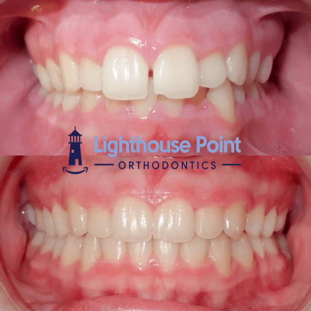 Lighthouse Point Orthodontics photo