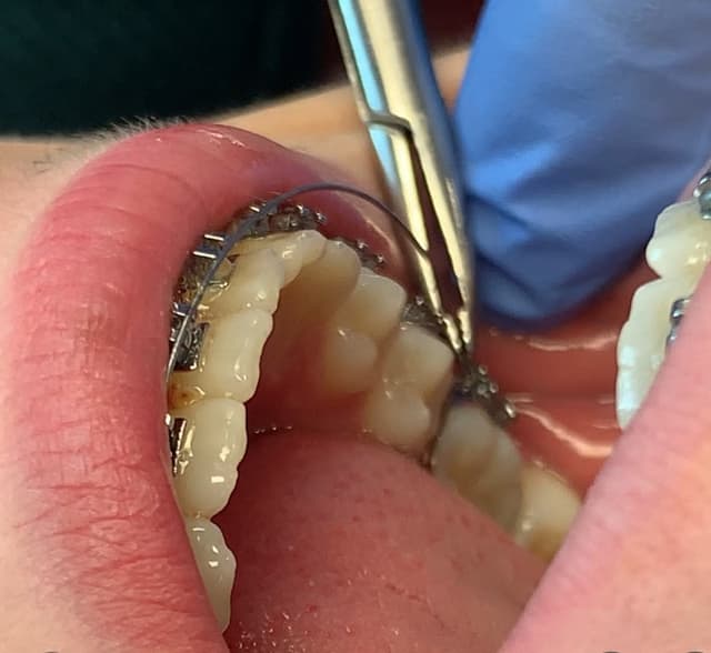 Hollywood Orthodontics photo