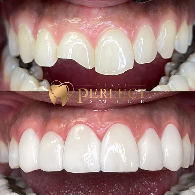 Miami Perfect Smile photo