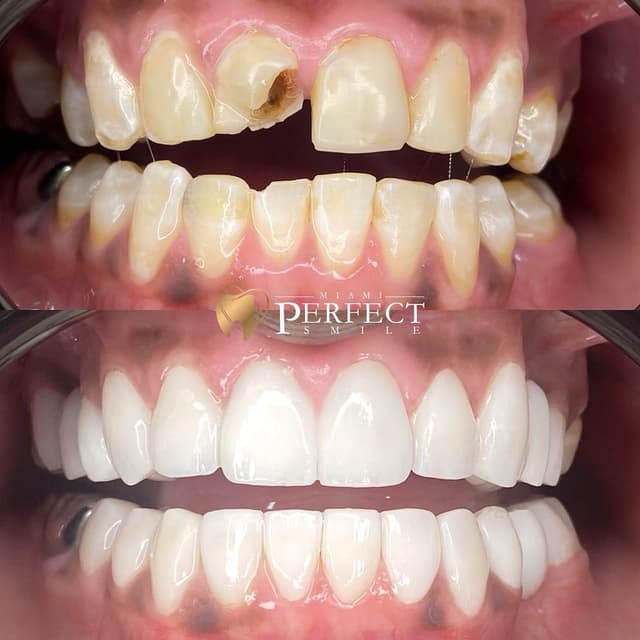 Miami Perfect Smile photo