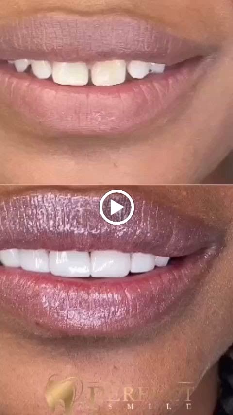Miami Perfect Smile photo