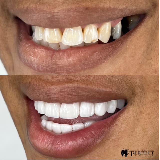 Miami Perfect Smile photo