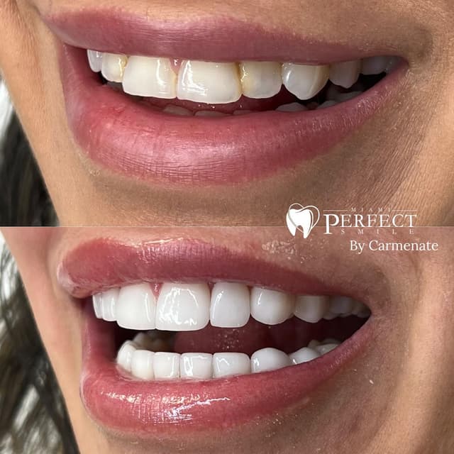 Miami Perfect Smile photo