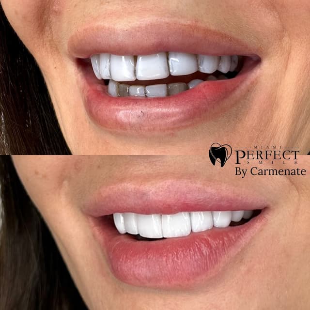 Miami Perfect Smile photo