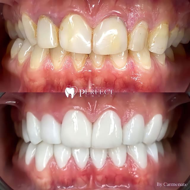 Miami Perfect Smile photo