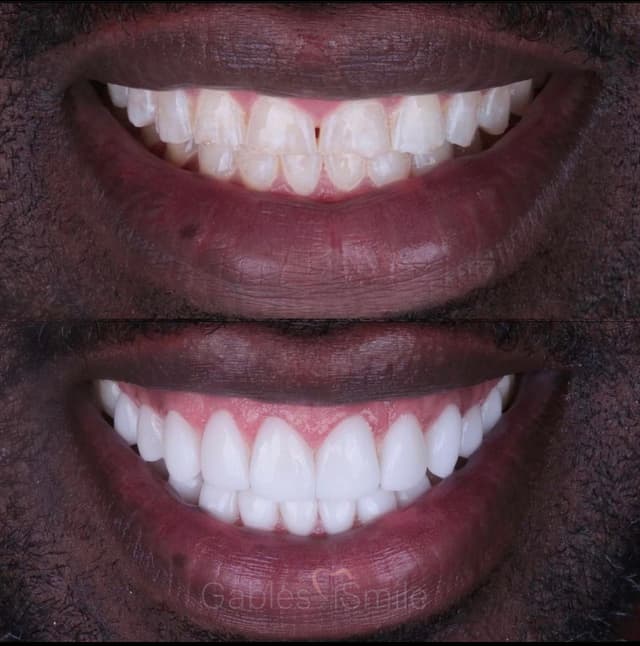 Gables iSmile photo