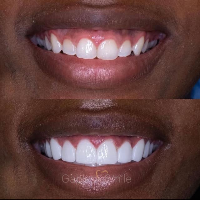 Gables iSmile photo