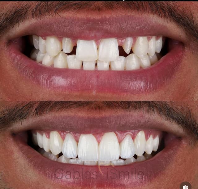Gables iSmile photo