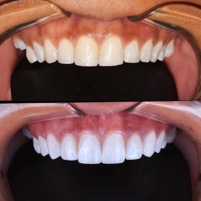 Gables iSmile photo