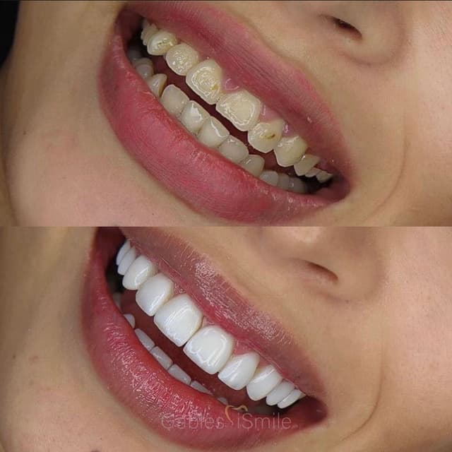Gables iSmile photo