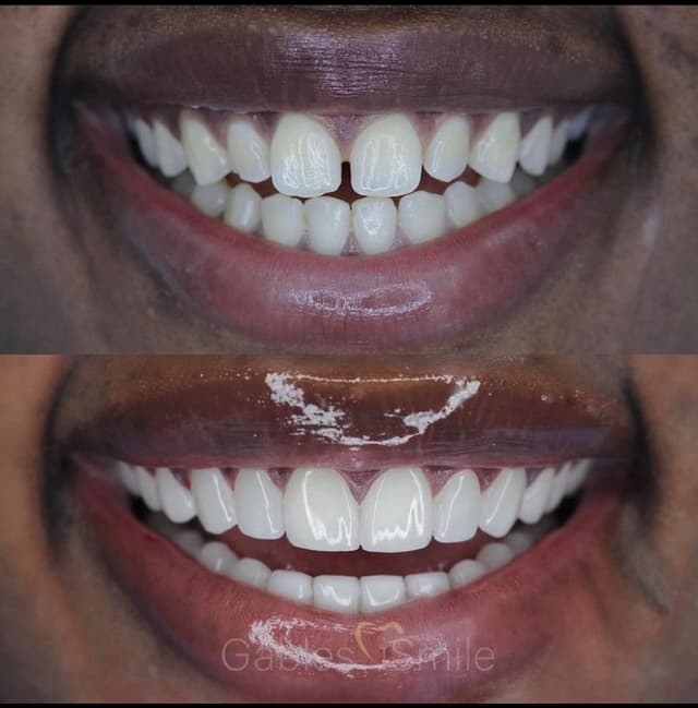 Gables iSmile photo