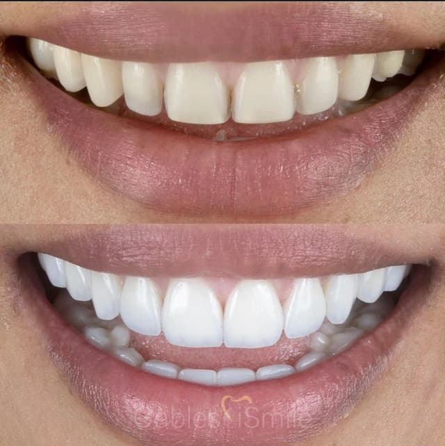 Gables iSmile photo