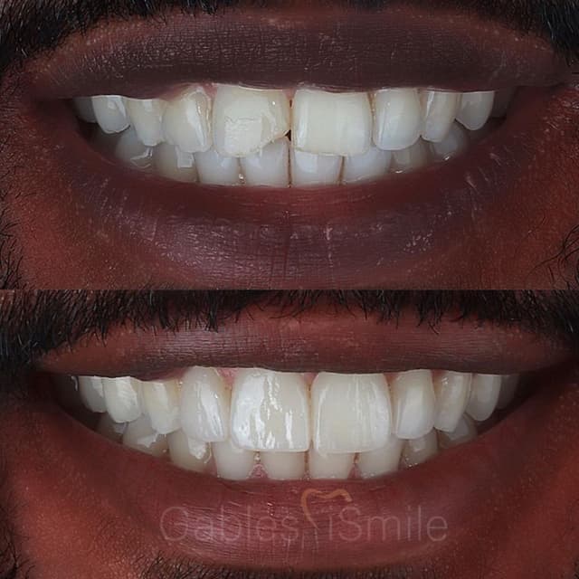 Gables iSmile photo
