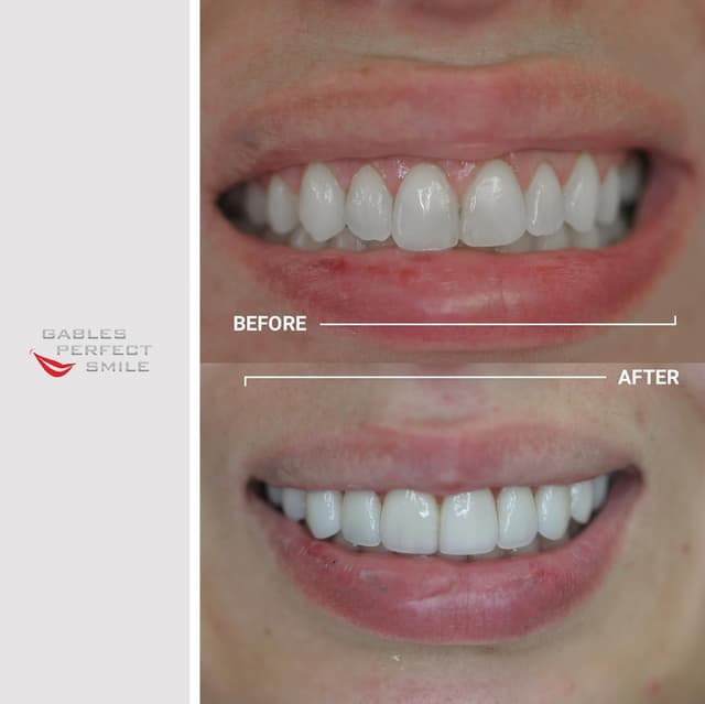 Gables Perfect Smile photo