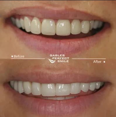 Gables Perfect Smile photo