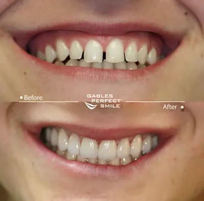 Gables Perfect Smile photo