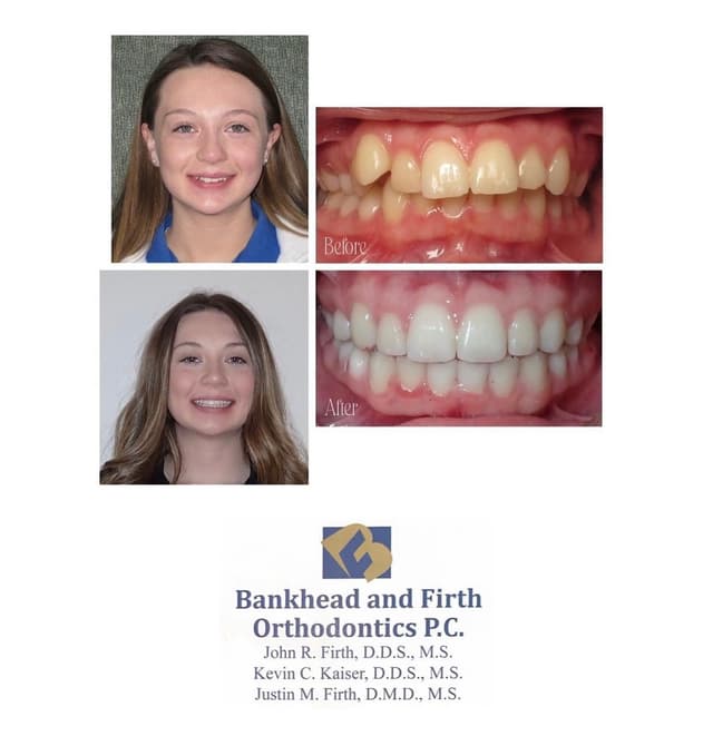 Bankhead & Firth Orthodontics photo
