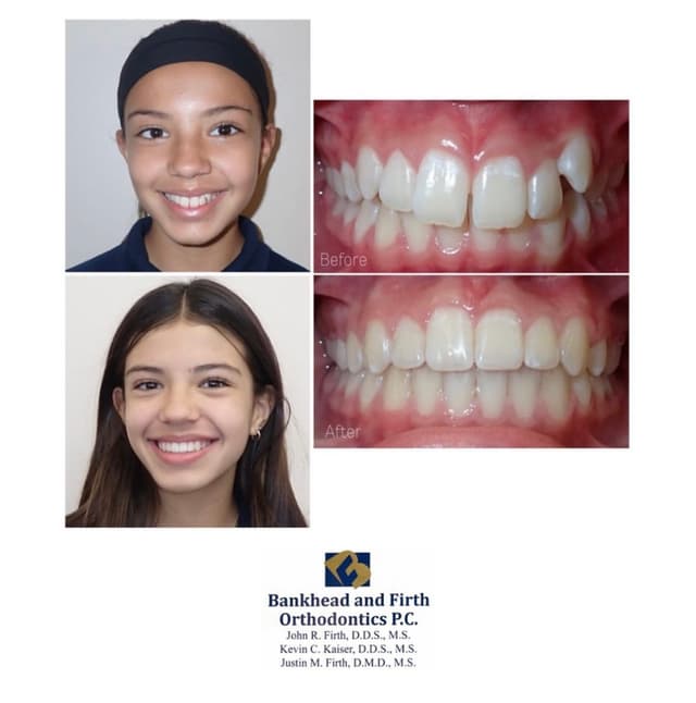 Bankhead & Firth Orthodontics photo