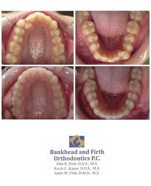 Bankhead & Firth Orthodontics photo