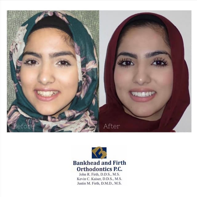 Bankhead & Firth Orthodontics photo