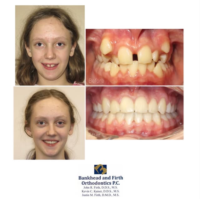 Bankhead & Firth Orthodontics photo