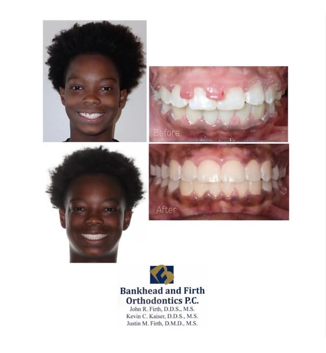 Bankhead & Firth Orthodontics photo