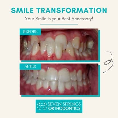 Seven Springs Orthodontics photo
