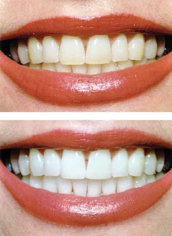 A Glamorous Smile photo