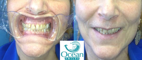 Ocean Smiles photo